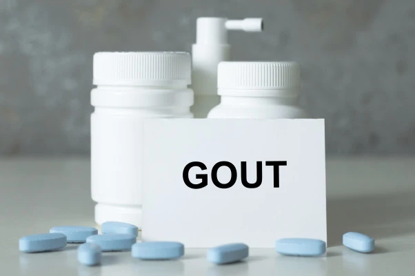 Gout Clinical Research Study in San Antonio