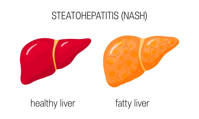 October is National Liver Awareness Month-Why Your Liver Health Matters!
