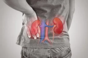 How Chronic Kidney Disease Develops