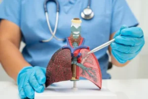 What “cirrhosis” means in plain English
